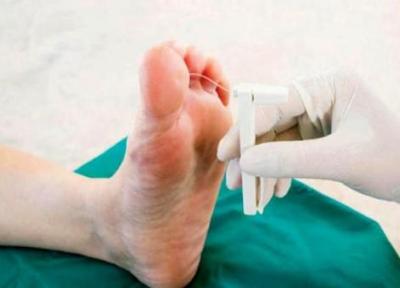 فناوری مدرن برای درمان زخم و پای دیابتی